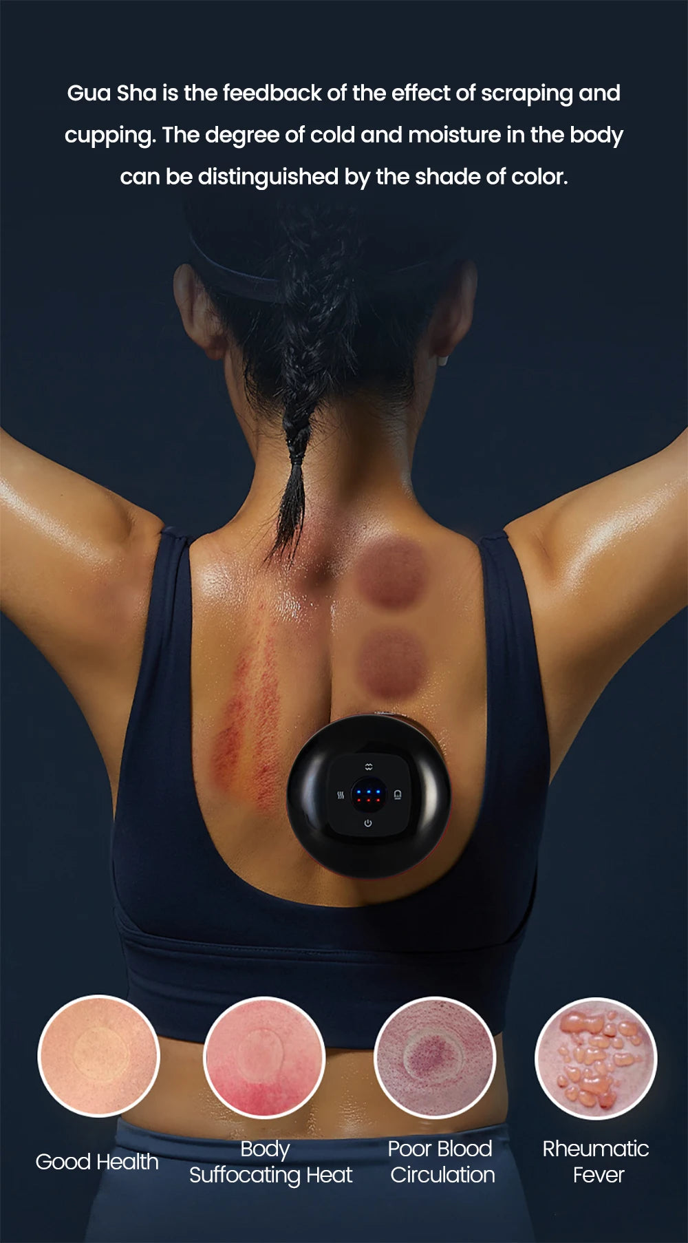 ELECTRIC VACUUM CUPPING MASSAGER