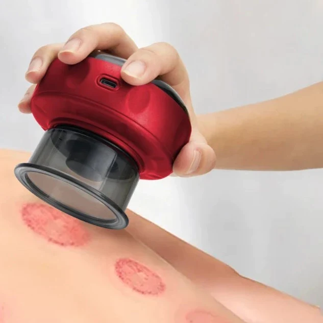 ELECTRIC VACUUM CUPPING MASSAGER